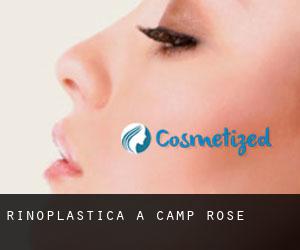 Rinoplastica a Camp Rose