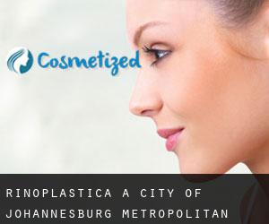 Rinoplastica a City of Johannesburg Metropolitan Municipality