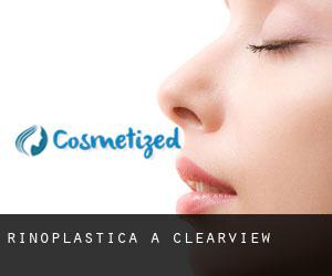 Rinoplastica a Clearview