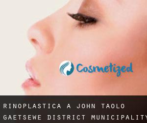 Rinoplastica a John Taolo Gaetsewe District Municipality