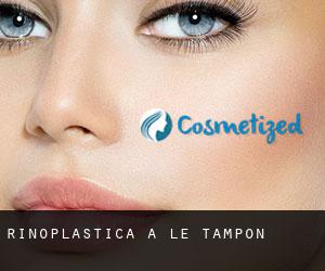 Rinoplastica a Le Tampon Rinoplastica a Le Tampon