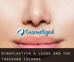 Rinoplastica a Leeds and the Thousand Islands