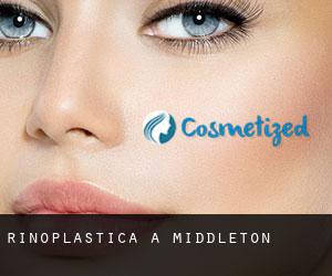 Rinoplastica a Middleton Rinoplastica a Middleton