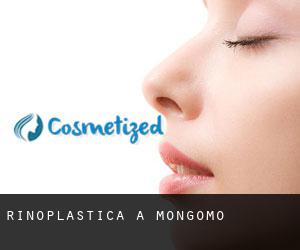 Rinoplastica a Mongomo Rinoplastica a Mongomo