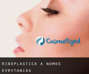 Rinoplastica a Nomós Evrytanías Rinoplastica a Nomós Evrytanías