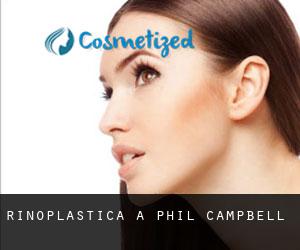 Rinoplastica a Phil Campbell