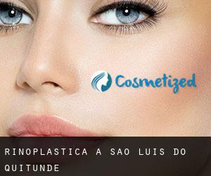 Rinoplastica a São Luís do Quitunde Rinoplastica a São Luís do Quitunde