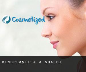 Rinoplastica a Shashi Rinoplastica a Shashi