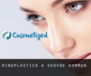 Rinoplastica a Skövde Kommun Rinoplastica a Skövde Kommun