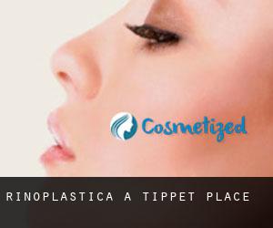 Rinoplastica a Tippet Place