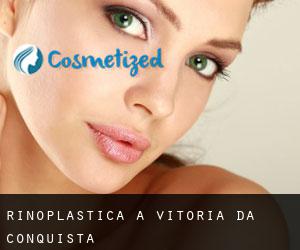 Rinoplastica a Vitória da Conquista Rinoplastica a Vitória da Conquista