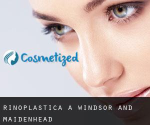 Rinoplastica a Windsor and Maidenhead Rinoplastica a Windsor and Maidenhead