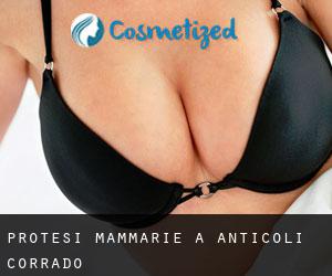 Protesi mammarie a Anticoli Corrado
