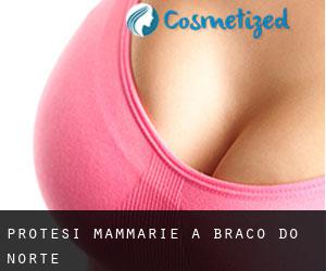 Protesi mammarie a Braço do Norte