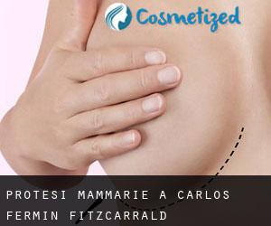 Protesi mammarie a Carlos Fermin Fitzcarrald
