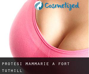 Protesi mammarie a Fort Tuthill