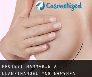 Protesi mammarie a Llanfihangel-yng-Ngwynfa