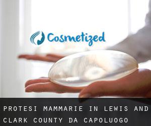 Protesi mammarie in Lewis and Clark County da capoluogo - pagina 1