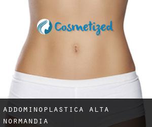 Addominoplastica Alta Normandia Addominoplastica Alta Normandia