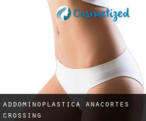 Addominoplastica Anacortes Crossing