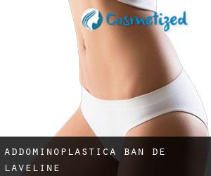 Addominoplastica Ban-de-Laveline