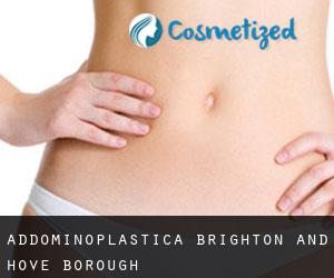 Addominoplastica Brighton and Hove (Borough) Addominoplastica Brighton and Hove (Borough)