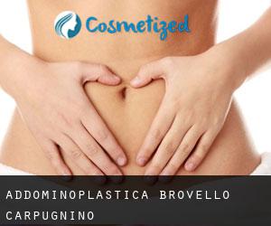 Addominoplastica Brovello-Carpugnino