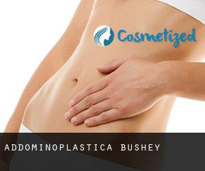 Addominoplastica Bushey Addominoplastica Bushey