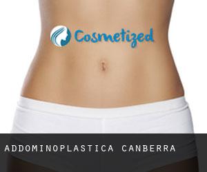 Addominoplastica Canberra Addominoplastica Canberra