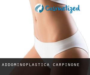 Addominoplastica Carpinone