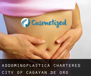 Addominoplastica Chartered City of Cagayan de Oro