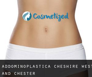 Addominoplastica Cheshire West and Chester