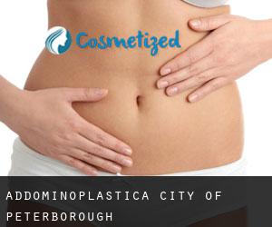 Addominoplastica City of Peterborough Addominoplastica City of Peterborough