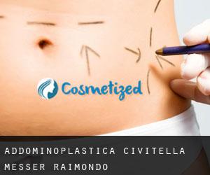 Addominoplastica Civitella Messer Raimondo