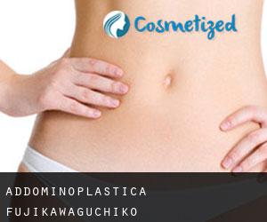 Addominoplastica Fujikawaguchiko Addominoplastica Fujikawaguchiko