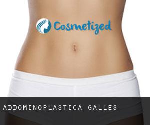 Addominoplastica Galles Addominoplastica Galles