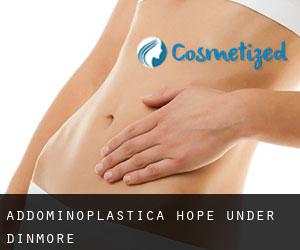 Addominoplastica Hope under Dinmore