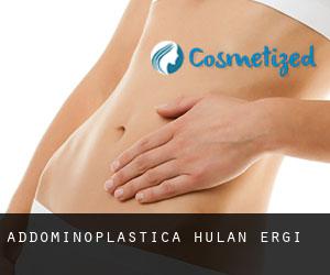 Addominoplastica Hulan Ergi Addominoplastica Hulan Ergi