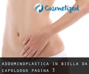 Addominoplastica in Biella da capoluogo - pagina 3