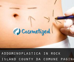 Addominoplastica in Rock Island County da comune - pagina 1
