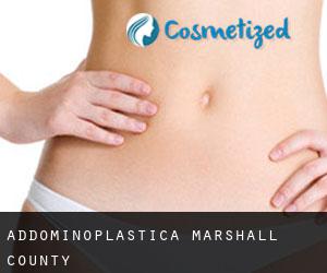 Addominoplastica Marshall County