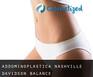 Addominoplastica Nashville-Davidson (balance)