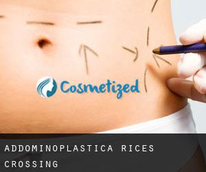 Addominoplastica Rices Crossing