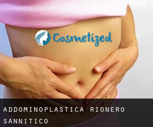 Addominoplastica Rionero Sannitico
