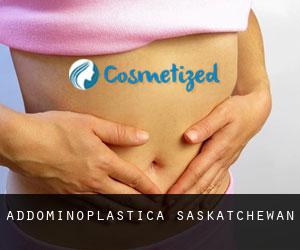 Addominoplastica Saskatchewan Addominoplastica Saskatchewan