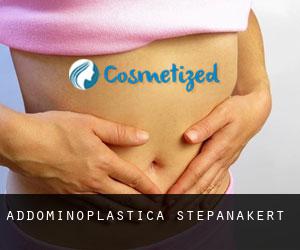 Addominoplastica Stepanakert Addominoplastica Stepanakert