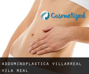 Addominoplastica Villarreal / Vila-real