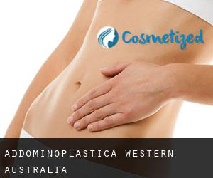 Addominoplastica Western Australia Addominoplastica Western Australia