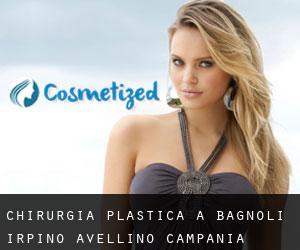 chirurgia plastica a Bagnoli Irpino (Avellino, Campania)