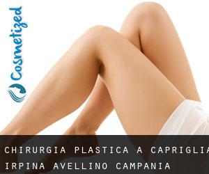chirurgia plastica a Capriglia Irpina (Avellino, Campania)